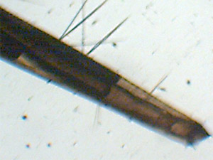 Sifone larvale di Culex pipiens